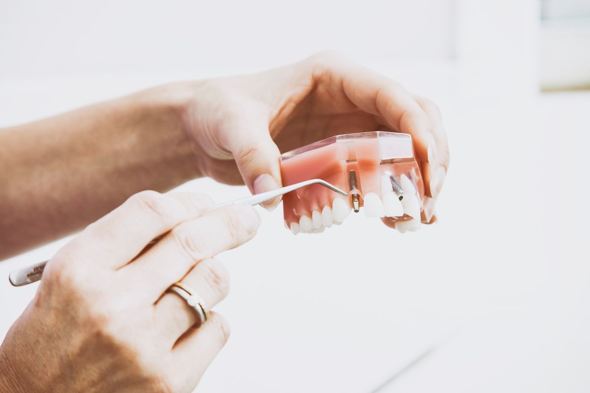 Dental Implant Recovery Facts You Need to Know Dental Implant Recovery Facts You Need to Know