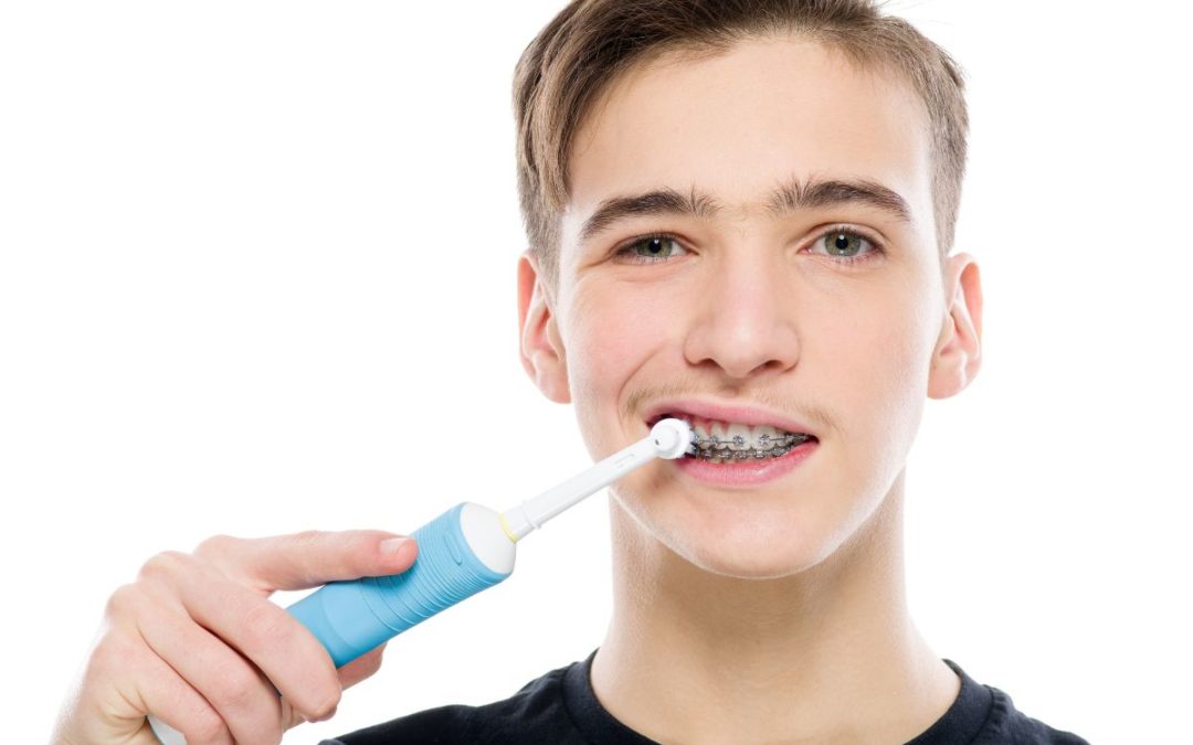 5 Things to Know about Caring for Your Braces